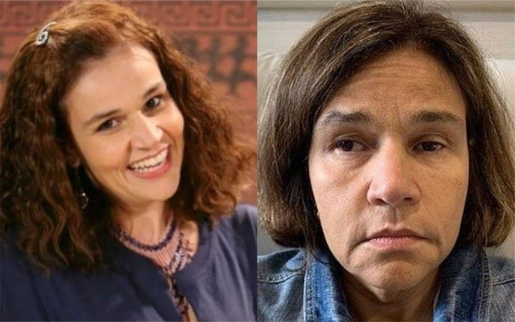 Claudia Rodrigues sofre acidente, é internada às pressas e detalhes de doença geram comoção: "Lesões no cérebro"