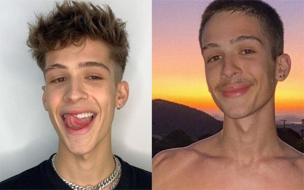João Guilherme, após exibir pacotão, surge com o rosto completamente desconfigurado e assusta: "O que é isso?"