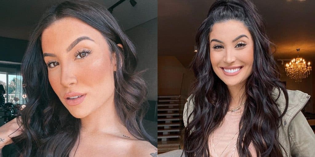 Bianca Andrade, após receber alta do hospital, realiza procedimento estético e choca com antes e depois