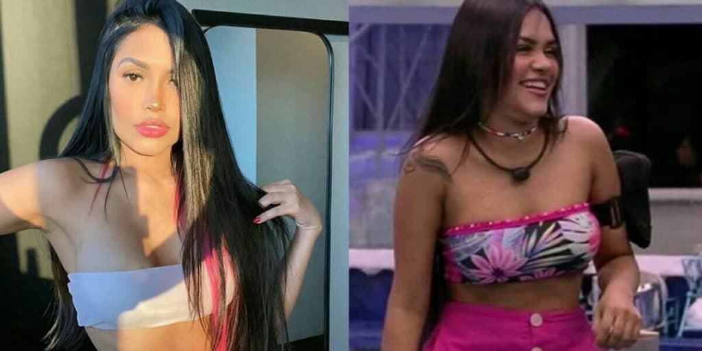 Ex-BBB Flayslane, após cirurgia no rosto, mostra nova plástica e choca: "Parece falso"