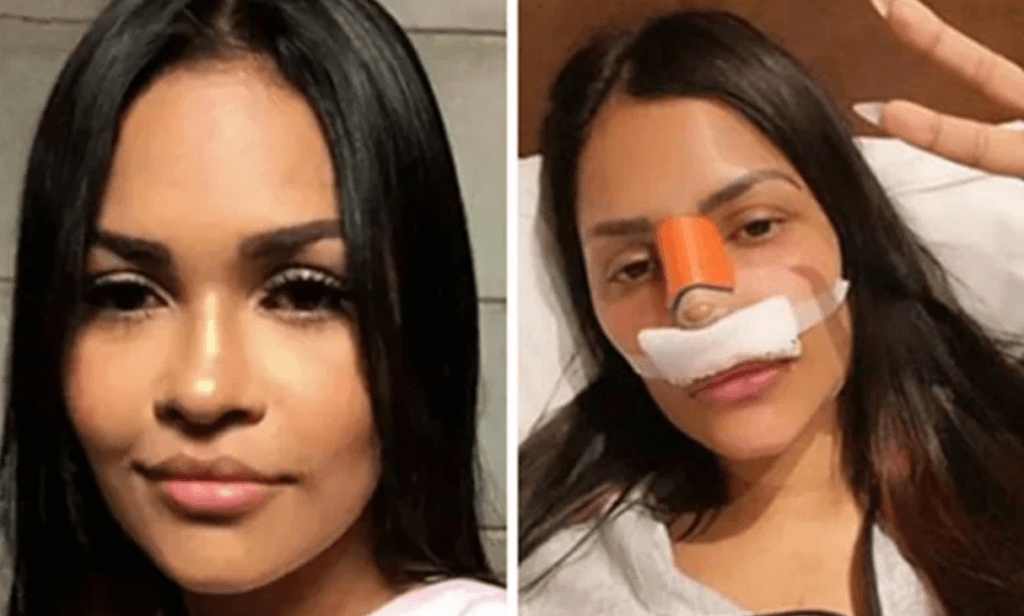 Ex-BBB Flayslane, após rinoplastia, anuncia novas plásticas e intriga os fãs: "Michael Jackson começou assim"