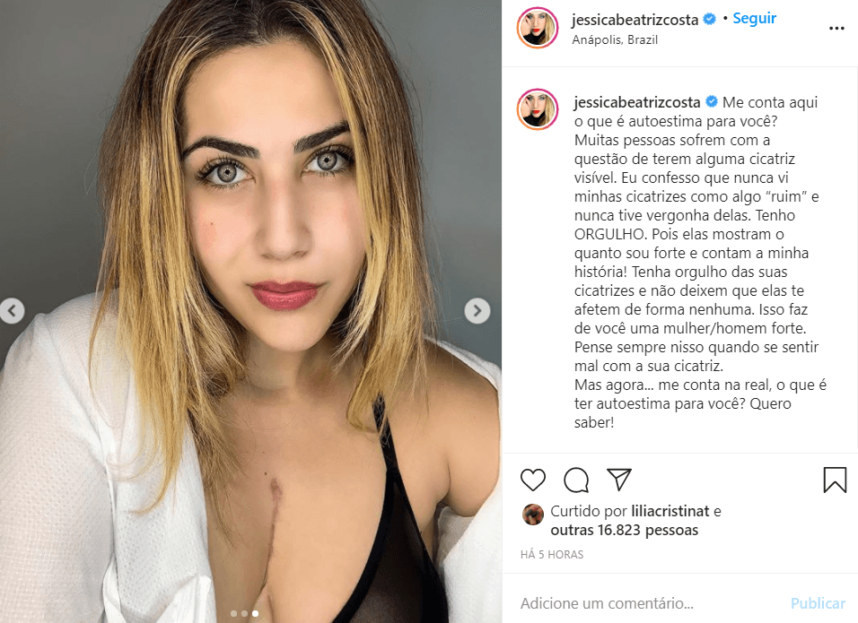 Imagem do post