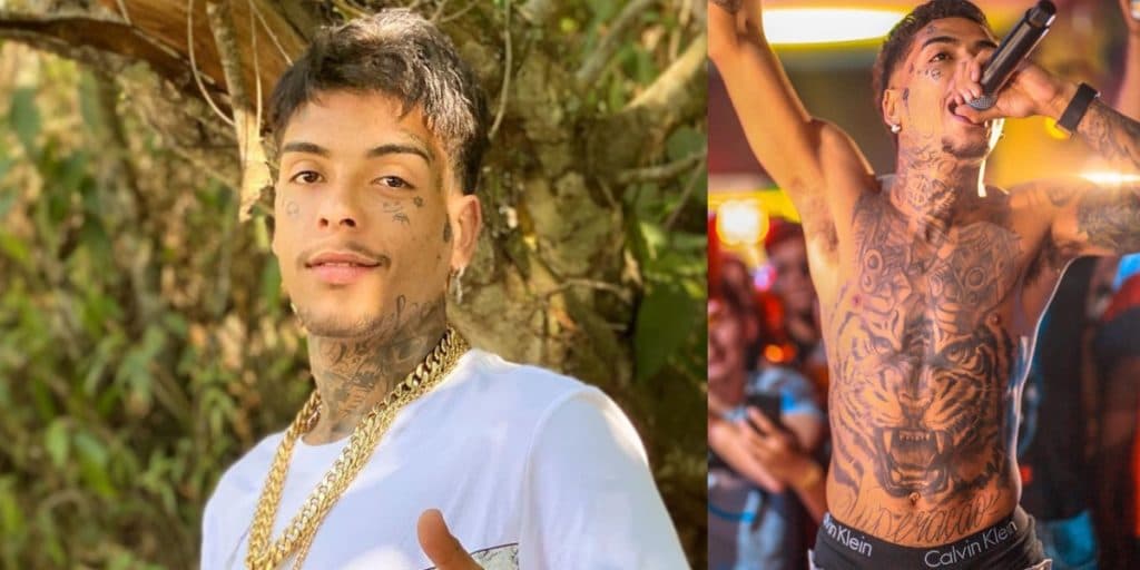 MC Kevin, após ter rosto deformado e deixar 'pinto' vazar, acaba com sonho de cantor e rasteira é dada: "Fez sumir"