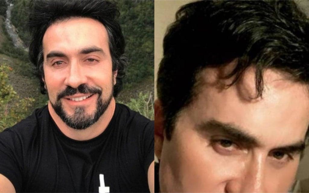 Padre Fábio Melo, após fazer tatuagem, muda radicalmente o visual e surge irreconhecível: "Preenchimento labial"
