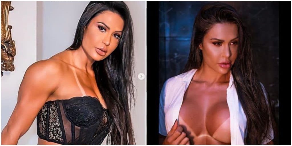 Gracyanne Barbosa faz cirurgia para deixar dependência, mostra aparência transformada e assusta com resultado