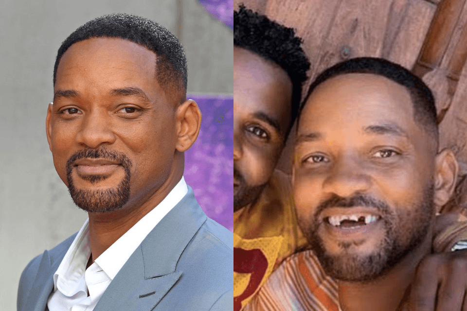 Banguelo! Will Smith, em partida de golfe com amigo, quebra os dentes após tacada no rosto e preocupa fãs