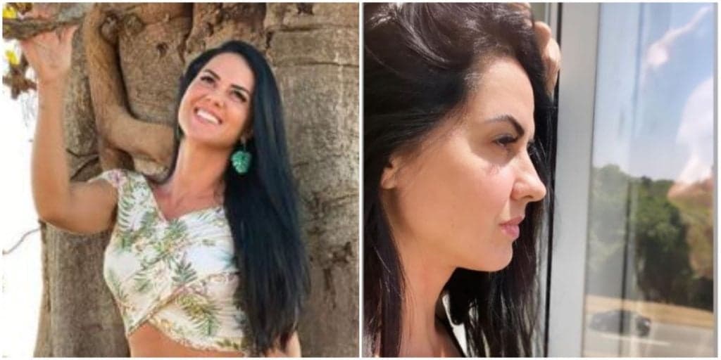 Graciele Lacerda entrega drama com o corpo, expõe defeito de anos e faz textão avassalador: "Não sabia"
