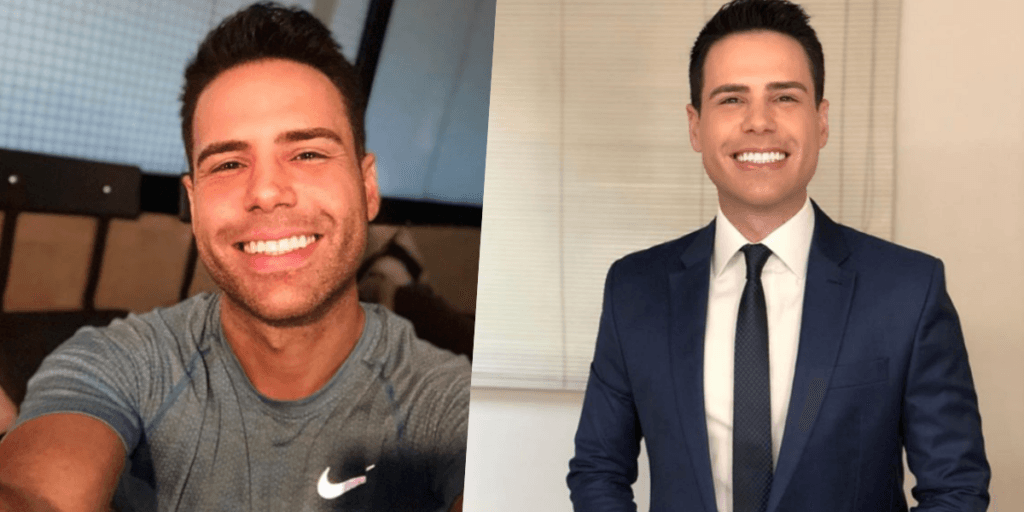 Luiz Bacci fala se seus dentes são de verdade e confessa: "Eu sou louco pra mostrar"