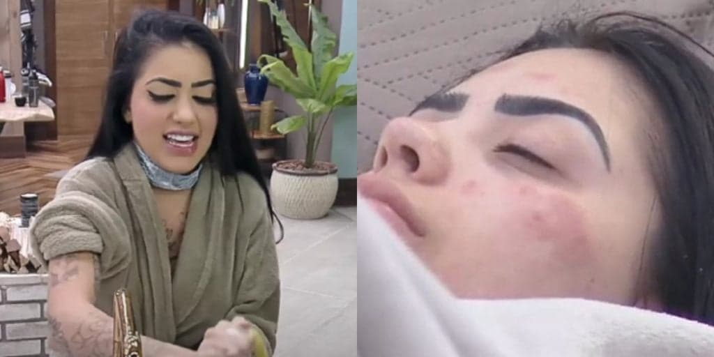 A Fazenda 12: Mc Mirella tem ataque dentro do reality, surge com rosto inchado e público implora por ajuda médica