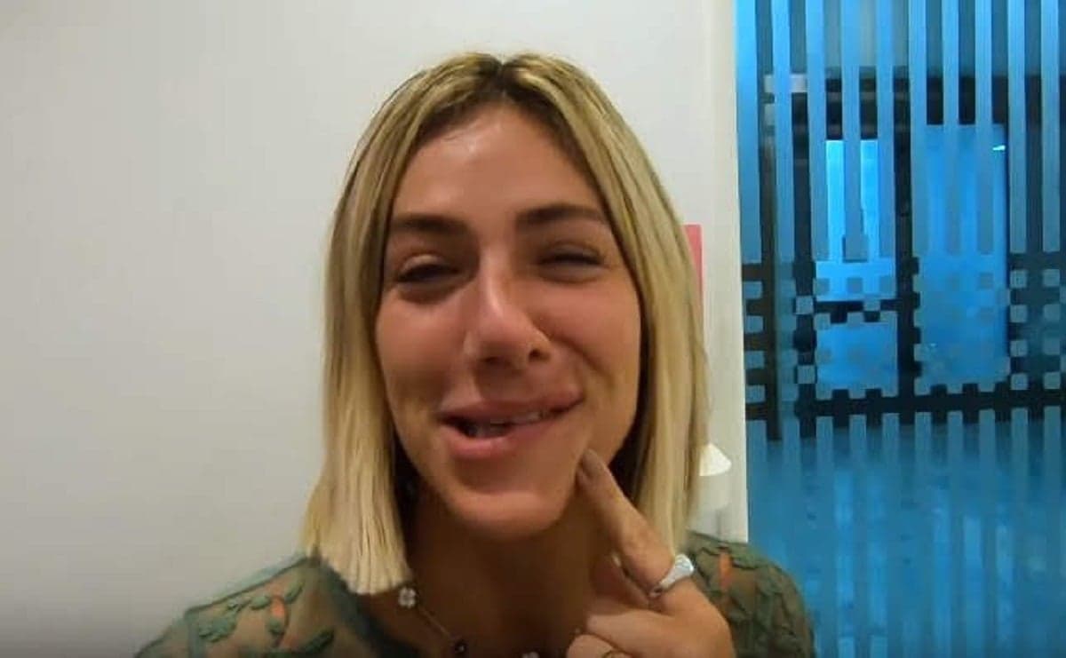 A esposa de Bruno Gagliasso confessou que ficou com o rosto torto após levar uma anestesia no dentista (Foto: Reprodução)