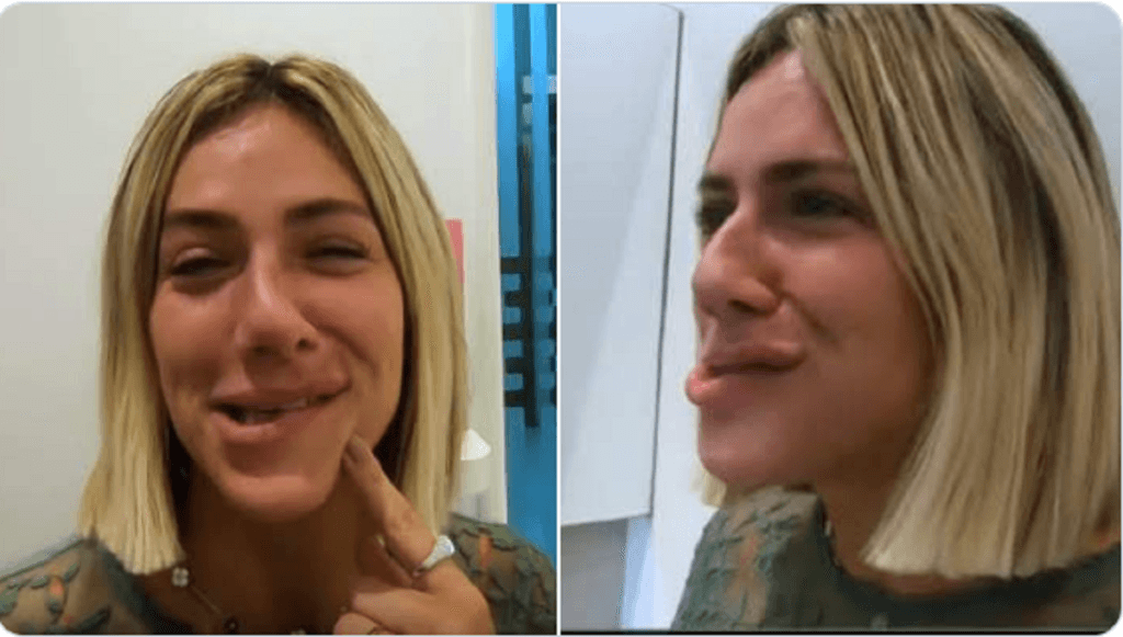 Giovanna Ewbank surge com rosto deformado após procedimento e público se espanta: "Meu Deus"