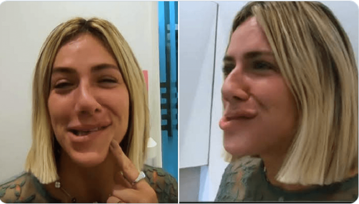 A atriz e apresentadora Giovanna Ewbank apareceu com o rosto todo torto depois de passar pelo dentista (Foto: Reprodução)