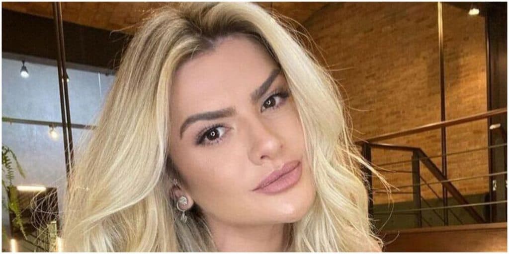 Mirella Santos sofre acidente, bate com a cabeça e passa por cirurgia