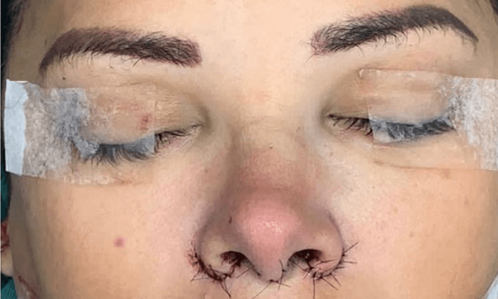 Ex-BBB Ariadna é submetida a cirurgia e fala sobre dor