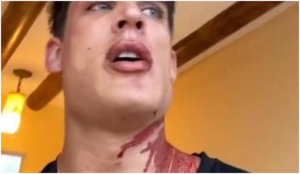 Tiago Ramos, ex da mãe de Neymar, surge em Cancun completamente ensanguentado e diz que foi esfaqueado