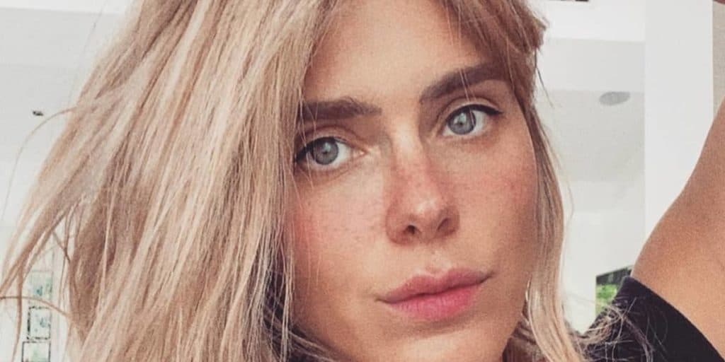 Carolina Dieckmann, após relatar perseguição, passa por cirurgia e retira parte do corpo: "Um monstro''