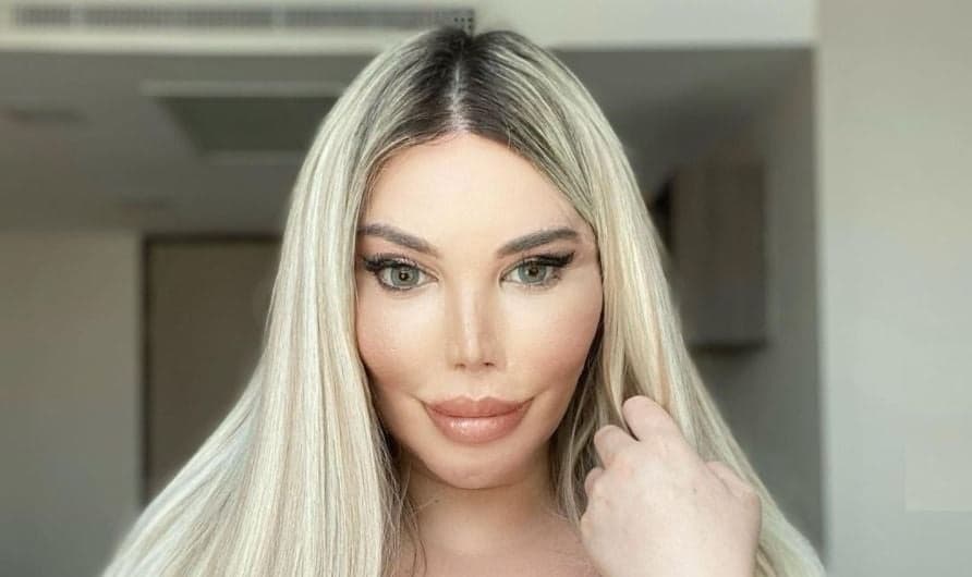 Ex-Ken Humano, Jessica Alves bota silicone ilegal, produto desce para os pés e imagens são chocantes