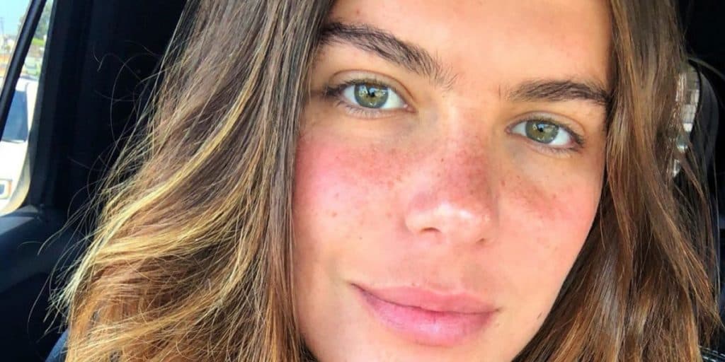 Mariana Goldfarb expõe doença grave e mostra corpo deformado