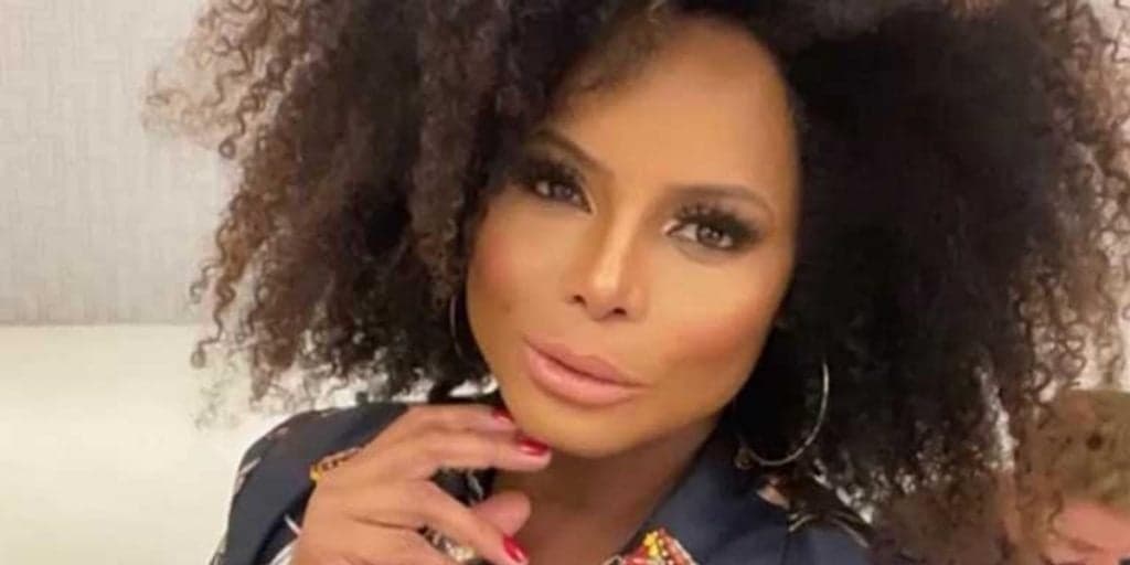 Adriana Bombom confirma retirada de órgão às pressas, após deixar o Power Couple um dia antes do início