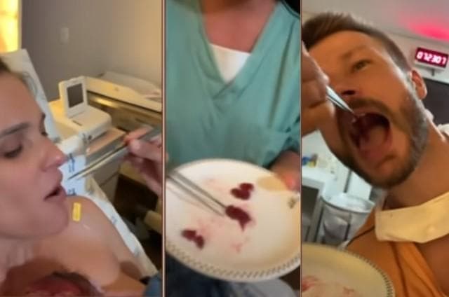 Fernanda Lima e Rodrigo Hilbert comendo placenta