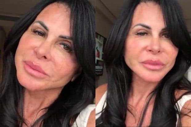 Gretchen faz cirurgia e muda radicalmente o rosto, chocando o público com o resultado: "Estranha"