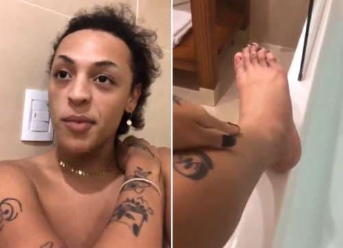 Pabllo Vittar perdeu unha do dedão após 'acidente' em festa (Foto: Reprodução/Instagram) Pabllo Vittar perdeu unha do dedão após 'acidente' em festa (Foto: Reprodução/Instagram)