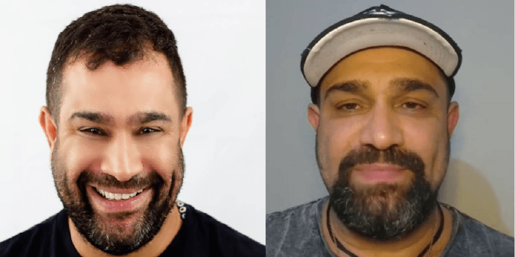 Evandro Santo, do Pânico, assume vício em droga e é internado pela 5ª vez: "É preciso coragem"