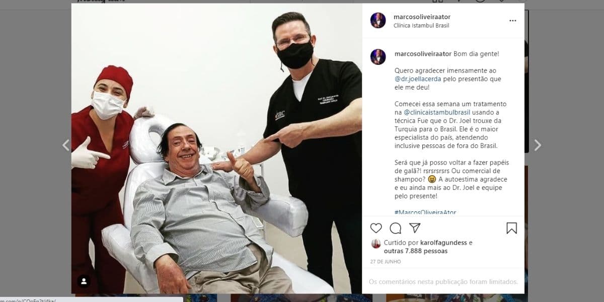 Beiçola confessa tratamento nas redes sociais (Reprodução) Beiçola confessa tratamento nas redes sociais (Reprodução)