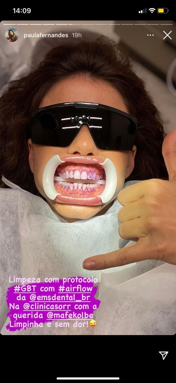 Paula Fernandes surge em maca de dentista com aparelho em sua boca (Reprodução)