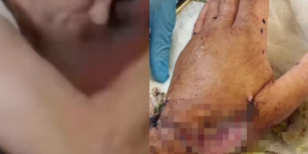 Ator é atacado brutalmente por tubarão em gravação, tem parte do corpo mutilado e canal anuncia: "Não está bem"