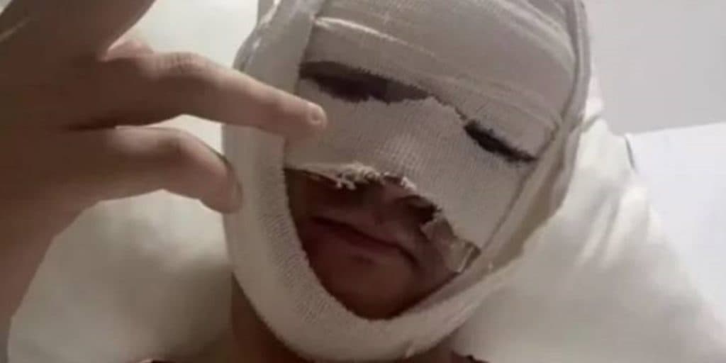 Querido ator sofre grave acidente e surge com o rosto todo enfaixado: "Explosão"