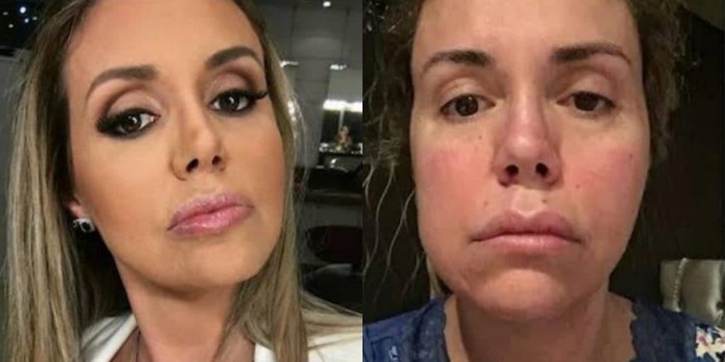 Renata Banhara revela câncer incurável no cérebro, necrose na cabeça e luta: "Filhos que dependem de mim"
