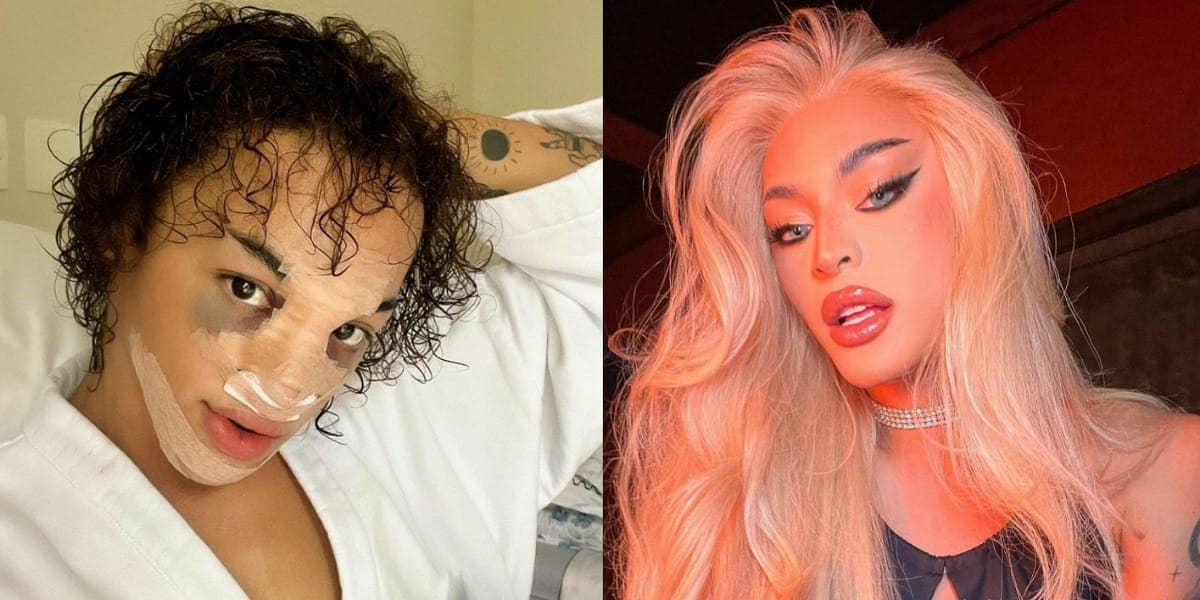 Pabllo Vittar se rendeu a uma cirurgia no nariz (Foto: Reprodução) Pabllo Vittar se rendeu a uma cirurgia no nariz (Foto: Reprodução)
