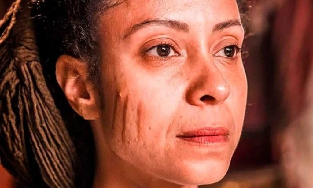 Nos Tempos do Imperador: Cicatriz de Justina dói muito na pele da atriz que confessa "Tive febre"