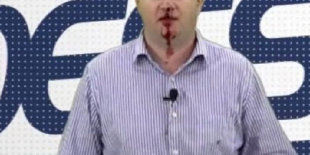 Apresentador é agredido em frente a emissora na qual trabalha e comanda programa todo ensanguentado