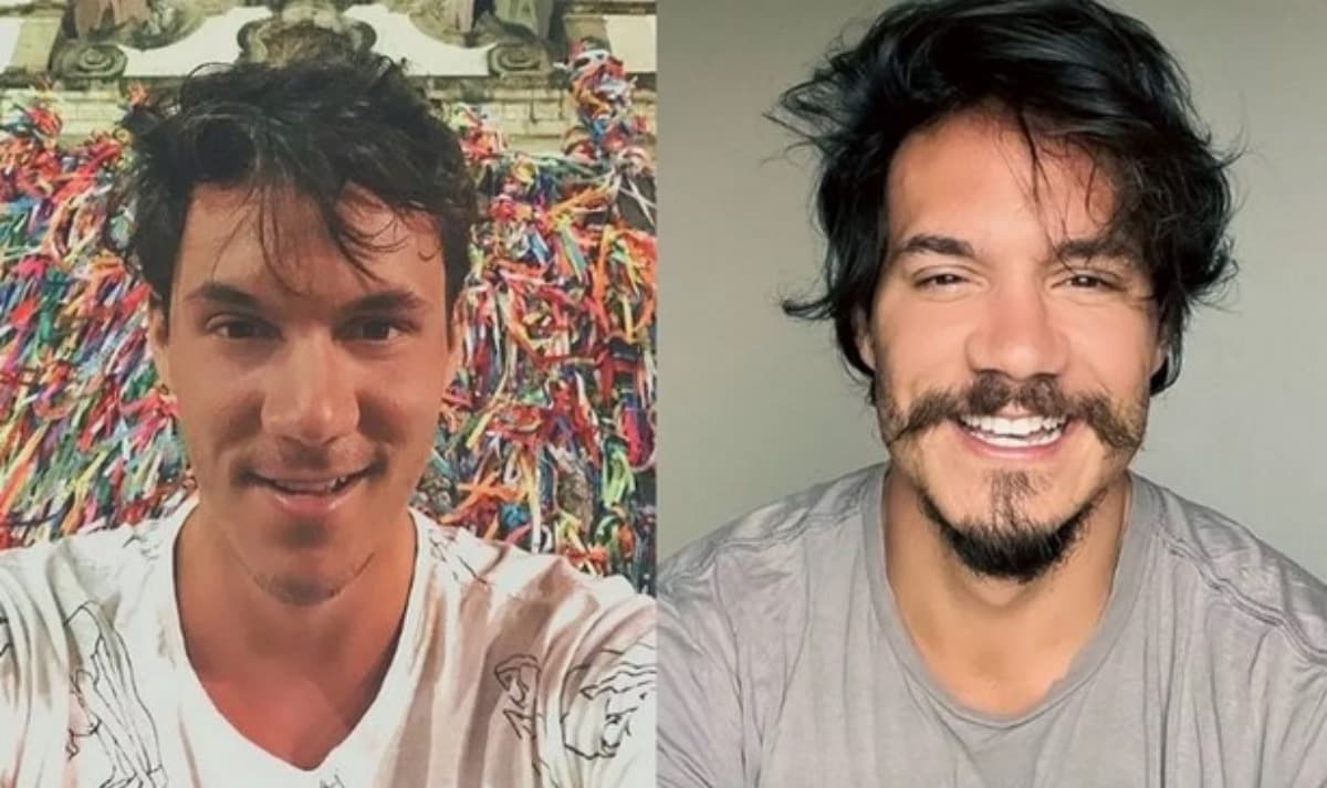 Eliezer do BBB22, antes e depois da harmonização facial (Foto: Reprodução / Instagram) Eliezer do BBB22, antes e depois da harmonização facial (Foto: Reprodução / Instagram)