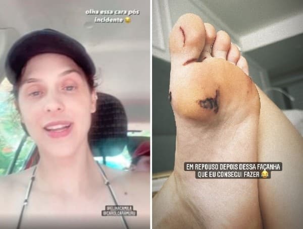 Sophia Abrahão cortou o pé e fez relato nas redes sociais (Imagem: Montagem) Sophia Abrahão cortou o pé e fez relato nas redes sociais (Imagem: Montagem)