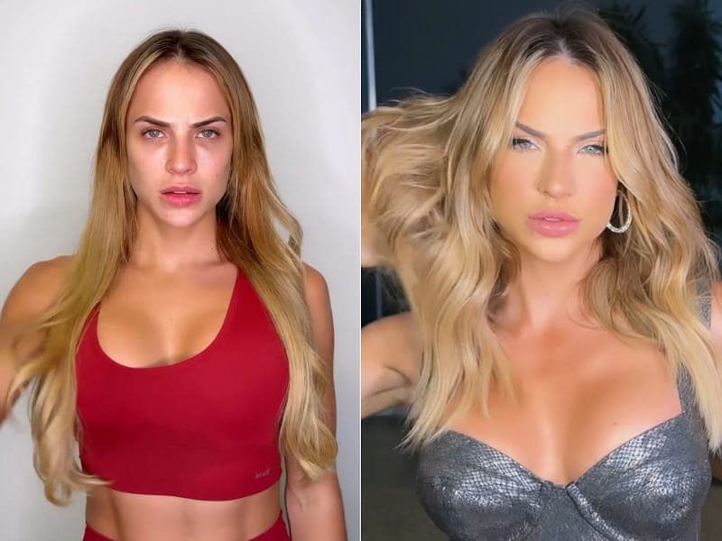 Ex-BBB Gabi Martins mostra antes e depois (Foto: Reprodução) Ex-BBB Gabi Martins mostra antes e depois (Foto: Reprodução)