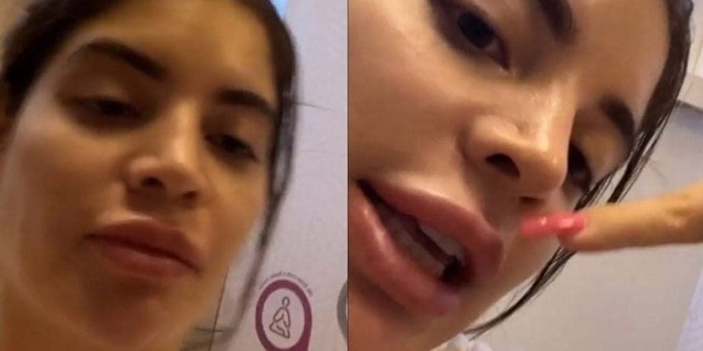 Gkay surge com corpo todo machucado, expõe o que aconteceu e desabafa ao público: "Difícil"