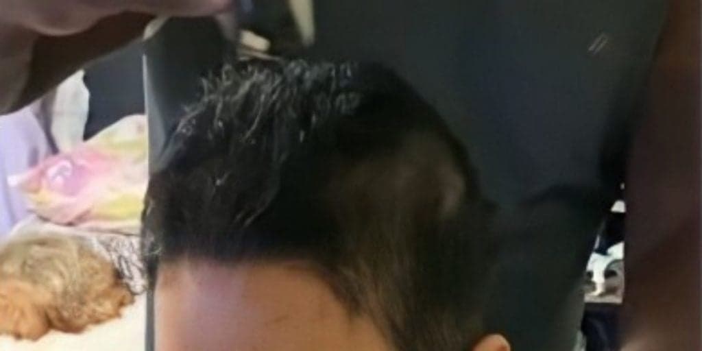 Esposa de famoso cantor surge em vídeo emocionante raspando o cabelo após retirada de tumor: "Meu Deus"