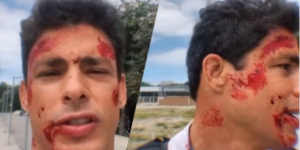 Cauã Reymond surge com rosto ensanguentado e expõe o que aconteceu na Globo: "É por isso que estou assim"