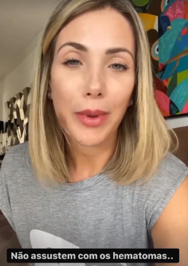 Érica Reis usa suas redes sociais para publicar vídeos explicando sobre o ataque e as consequências (Reprodução/ Instagram) Érica Reis usa suas redes sociais para publicar vídeos explicando sobre o ataque e as consequências (Reprodução/ Instagram)