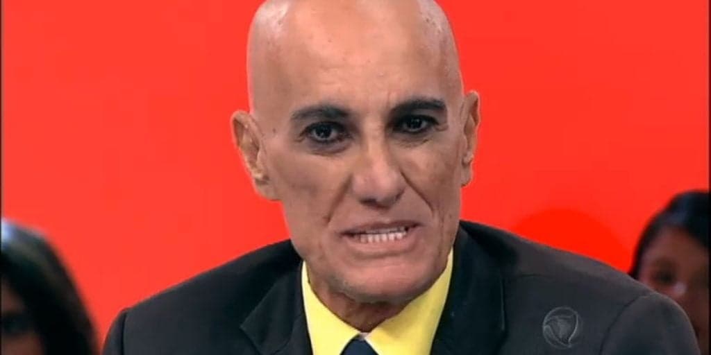 Amin Khader passa por cirurgia, surge com rosto enfaixado e relato é feito: "Depois de quatro"
