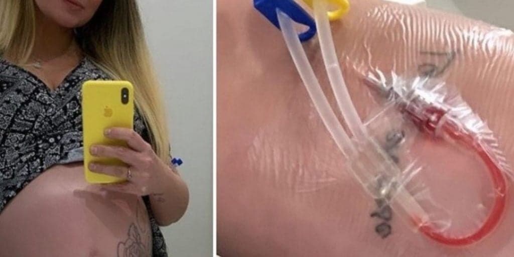 Famosa cantora, após perder filha, sofre com nova gravidez, toma mais de 700 injeções e tem risco de AVC