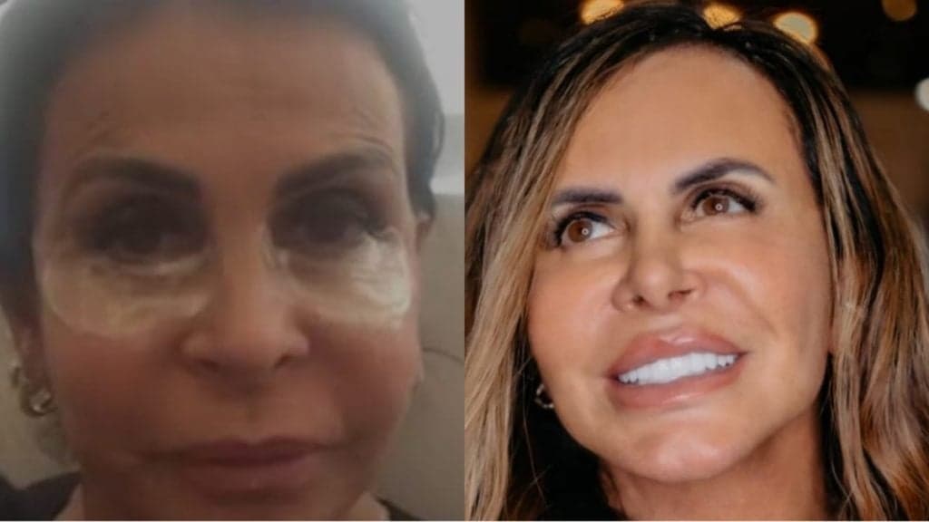 Gretchen faz novo procedimento estético, tatua em volta dos olhos e expõe verdade: "Sempre tive vergonha"