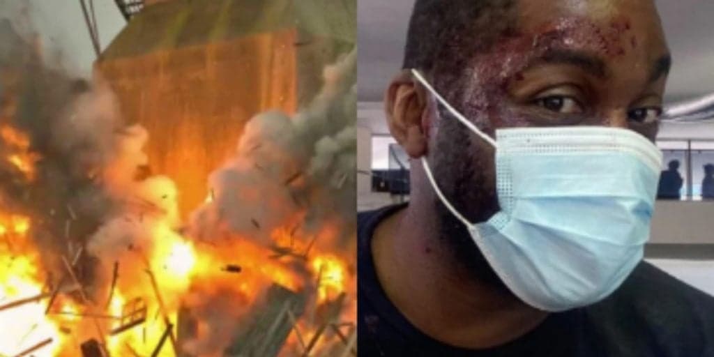 Lázaro Ramos surge estraçalhado após explosão e foto do acidente causa desespero; entenda