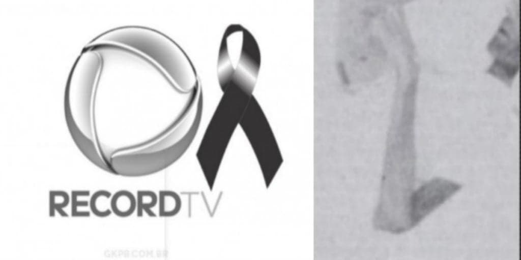 Luto na Record! Apresentador morre após câncer agressivo e última foto em leito do hospital é divulgada