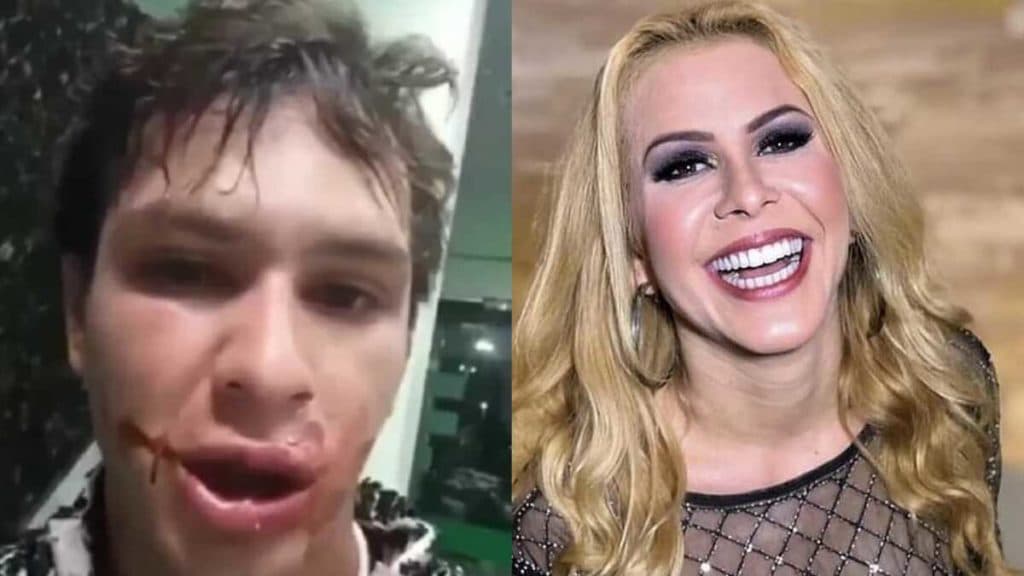 Desfigurado: Repórter do SBT deixa show de Joelma em Manaus e acaba brutalmente espancado; veja