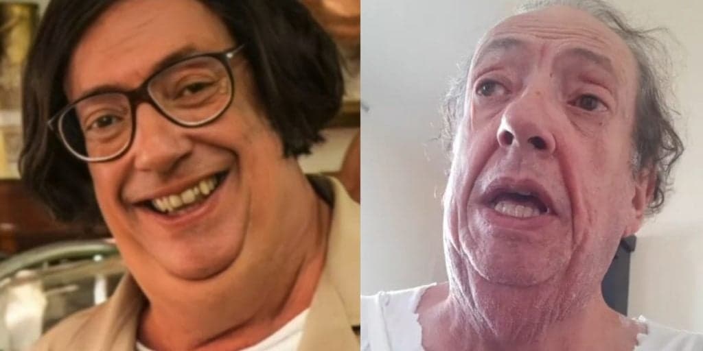 Marcos Oliveira, o "Beiçola", surge abatido e pede ajuda de fãs para custear cirurgia: "Por favor, me ajudem"