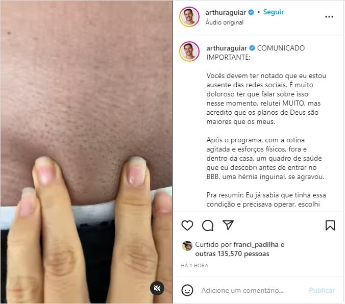 Arthur Aguiar confirma sério diagnóstico e cirurgia - Foto: Reprodução